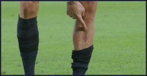 Carrasco, rdeči karton, kamere