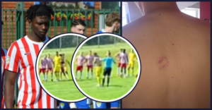 Svoboda, Roltek Dob, ugriz